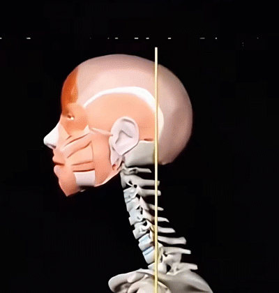 UPRIGHT™ Posture Corrector